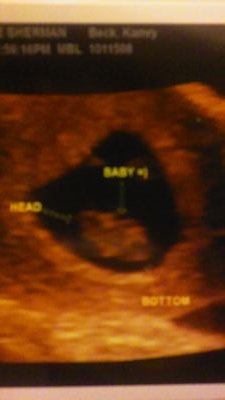 Mz_Cutie94's profile picture. Follow me on IG: Mz_CutieKam94
SnapChat: Mz.Cutie_Kam
Taken: 05~12~11❤
#collegegirl
#Engaged
#justbeingme
#soon to be mom