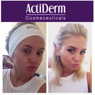 ActiDerm ambassador. Products that really work!! RECRUITING - email: Chloe@ActiLifestyle.com Instagram: @Actiderm_lifestyle