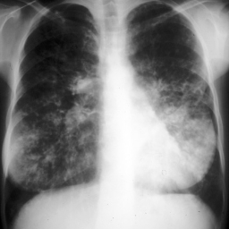 Wheezing, coughing, spluttering, medicine taking Mum of 2 Cystic Fibrosis fighter. Living a life unlimited by squatting, lunging, power lifting & trying to run.