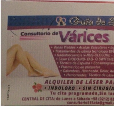 Médico Flebologo Varices Varices y sus complicaciones Úlceras venosas Flebología M.T.S V.F.L M.T.S V.C.E.V