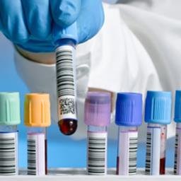 La voz de muchos sanitarios trabajadores de laboratorios de biotecnología de Andalucía.