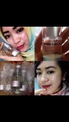 menjual THERASKIN BERBPOM & SUDAH TERDAFTAR MUI, pass respon SMS / WA 08993167411