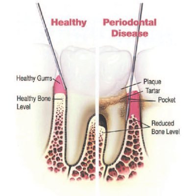 Aspiring dental student. I am in the process of blog writing about my ambition to be a dental practitioner, also doing a research project on the cure for HIV