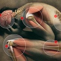 Fibromialgia (@fibromialgianew) 's Twitter Profile