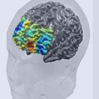 Motion Analysis Lab (@bev_lab) 's Twitter Profile