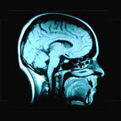 SPAZZNiBLET's profile picture. A sarcastic bastard who always points out the truth.