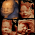 Hello Baby 4D Scan (@hellobaby4dscan) Twitter profile photo Hello Baby 4D Scan (@hellobaby4dscan) Twitter profile photo