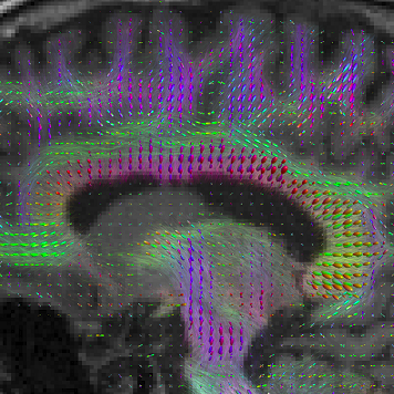 Tweeting about diffusion MRI, structural brain connectivity and graph theoretical analysis. Curated by @TimoRoine, a post-doc at the Aalto University, Finland