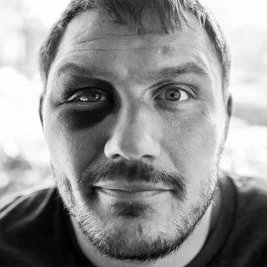 Matt Mitrione On Twitter Broken Orbital Floor This And The