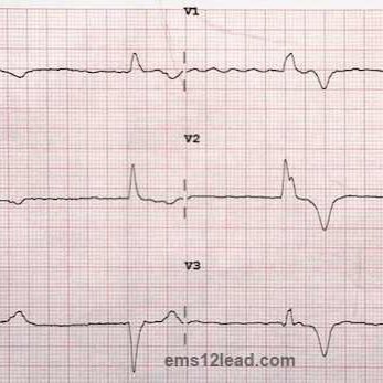 ECGoftheday's profile picture. an extension of my Facebook page, ECG of the day. this page should mirror Facebook starting today as well. answers to the ECGs will be posted on the blog.