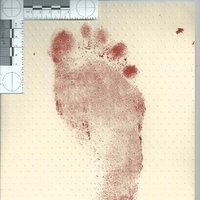 Forensic Podiatry (@forensicpod) 's Twitter Profile