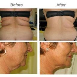 #weightloss #medicalweightloss #teethwhitening #massage #cosmeticinjections #botox #hairremoval #medispa