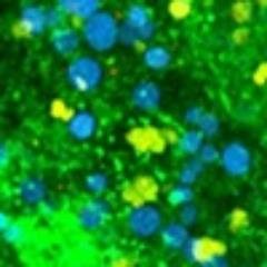 MRG Newcastle Profile