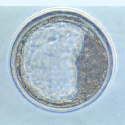 Un embryon perdu | Compte tenu par une cellule cyncitiotrophoblastique
