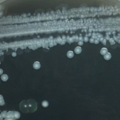 CNRS researcher in @CIRI_Lyon, Team HGT in bacterial pathogens (@labXC) Working on transformation in L. pneumophila https://t.co/pf7kl8ImnB
