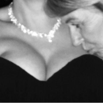 BRCA2+ crying & laughing through TN Breast Cancer at 34, Cervical Cancer at 39 double mastectomy at 41, HRT fan #breastcancer #tnbc #cervicalcancer #HRT