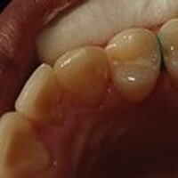 Caries Research 2.0 (@cariesresearch) 's Twitter Profile