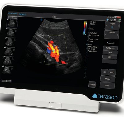 Terason Ultrasound