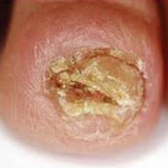 toesnailfungus's profile picture. 