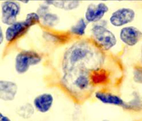 onconet's profile picture. Actualization in oncology research