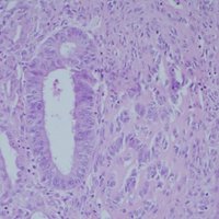 GYN Pathology (@gynpath) 's Twitter Profile