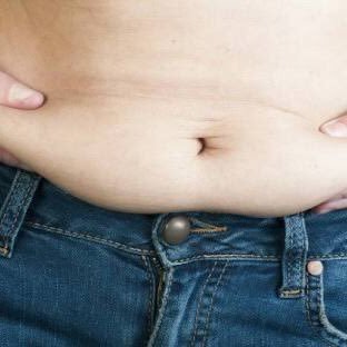 _Thomas_Wilde_'s profile picture. I have lost all the weight, now I need to lose the excess skin. Please help if you can