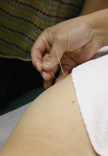 Acupuncture Tips, providing traditional Chinese Medicine tips and guide.