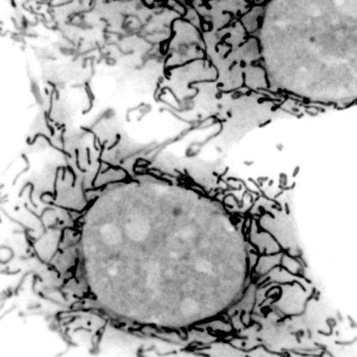 Autophagozoom's profile picture. Trying to ùnderstand how cancer cells adapt their metabolism and use 'Self-eating' to survive and evade treatment. Love #microscopy. #autophagy #cancer