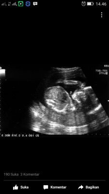 ipoypisan's profile picture. 