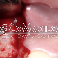 Dr. David Castro (@cxmaxilo) 's Twitter Profile Photo Dr. David Castro (@cxmaxilo) 's Twitter Profile Photo