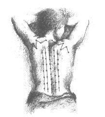 seattleacu's profile picture. Seattle LAc - Traditional & Five Element Acupuncture for healing illness and pain.