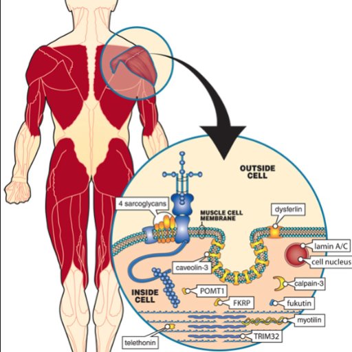 Blogger with late onset limb girdle muscular dystrophy.