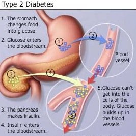 This account is part of a final science class project, dedicated to the management and treatment of Type 2 Diabetes.