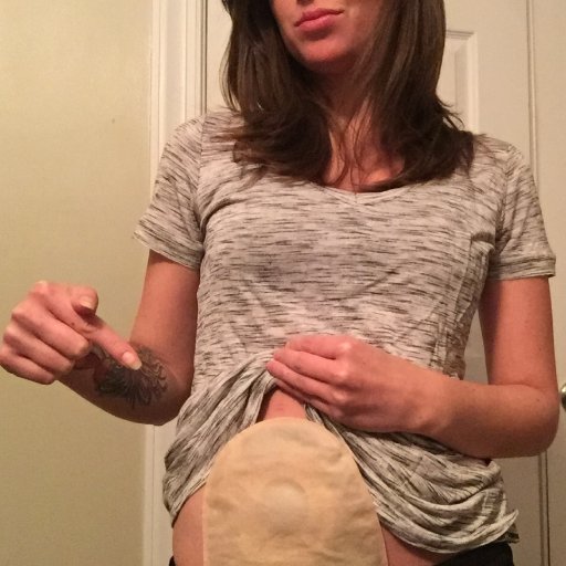 I write about life as a woman/mother/human with an ostomy and IBD at The Stolen Colon.