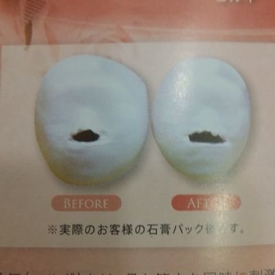 韓国小顔骨気embrer アンベレア Kogao Embrer Twitter 韓国小顔骨気embrer アンベレア Kogao Embrer Twitter
