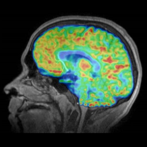 MGH_ChemNeuro's profile picture. Advancing our understanding of the brain through the development and application of molecular imaging agents | @mghmartinos