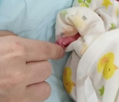 akya1yan1011632's profile picture. 調剤事務→病院の薬剤部に転職。掌蹠膿疱症を発症して17年半。

2015年5月13日稽留流産の手術を受ける。
2016年4月10日23週4日で子宮内胎児死亡(原因:臍帯過捻転)の宣告、4月18日女の子を出産。

2017年5月29日無事レインボーベビーを出産。
2019年4月～2023年3月妊活するも妊娠に至らず断念。