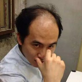 若ハゲ太郎です!薄毛やハゲは遺伝だから仕方ないと思っていませんか??安心して下さい!現在は発毛効果を期待できる育毛剤が沢山あります。ハゲリーマン卒業!
共感できたらFW&RTお願いします!
相互でFWさせてもらいます。
サイト(29歳の若ハゲが6ヶ月で回復した方法?)⇒https://t.co/g0oAcTo1dW