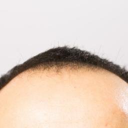 ハゲ研 はげと薄毛の対策 予防を開設 Hagekencom Twitter