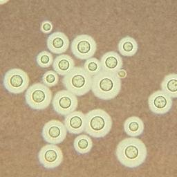 Crypcoc_Neoform's profile picture. Well, im a Yeast and my family's name is Tremellaceae. My mother gave birth to me ( budding ) on 12am 10/5/2016 on someone's lungs.