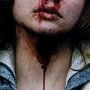 betweenrp's profile picture. When a virus kills everyone over twenty-one in the small town of Pretty Lake, those left alive are quarantined and must figure out how to survive.