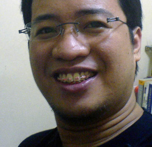 bote't dyaryo