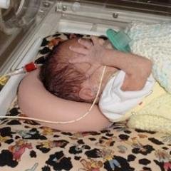 Head support for preemies & full term babies used in hospitals worldwide. Dramatically reduce the chance that your baby will suffer Flathead Syndrome.