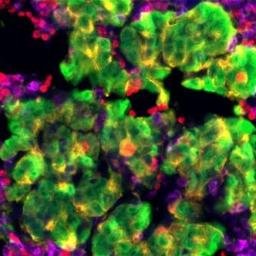 Alert for pre-print manuscripts on Cancer biology research, sources bioarxiv #openaccess #cancer #oncology (photo @IRPatNIH) by @wpgilks