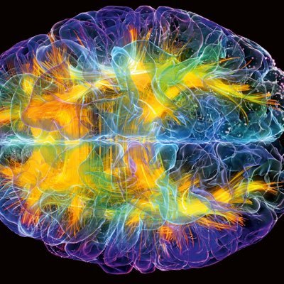 Neurology Chiropractor Brain chironeuro functionalneurology