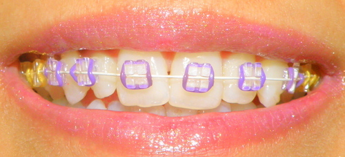 Orthodontist,dentist,smile artist, braces doc