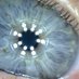 Helen Davis OBE (@helenorthoptics) Twitter profile photo Helen Davis OBE (@helenorthoptics) Twitter profile photo