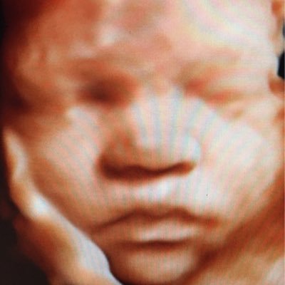 invision3d4d's profile picture. A boutique-style 3D4D imaging center, now offering HDlive to parents-to-be, family and friends, giving them an opportunity to see their baby before they arrive!