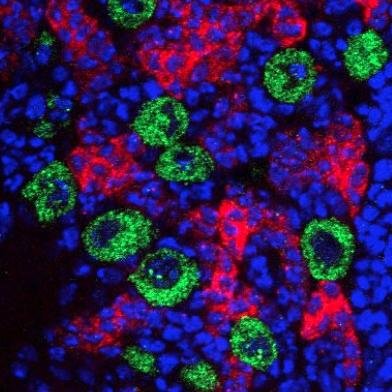 At the Department of Biochemistry, Oxford University. We focus our research on the role of RNA biology in brain development and synaptic plasticity