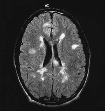 Bull Dead / Alive, Now doing: Personal support, Turnarounds & Crisis management, Psychology, Neuro-degenerative diseases, Multiple sclerosis, Iphone R&D